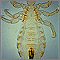 Body louse Body louse