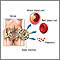Bone-marrow transplant - series Bone-marrow transplant - series