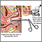 Colposcopy-directed biopsy Colposcopy-directed biopsy