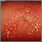 Pustules - superficial on the arm