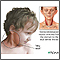 Torticollis (wry neck) Torticollis (wry neck)