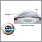 Lasik eye surgery - series - Normal anatomy
