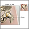 Hip joint replacement - Series Hip joint replacement - Series