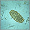 Ascaris lumbricoides egg Ascaris lumbricoides egg