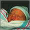 Jaundiced infant