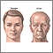 Changes in face with age Changes in face with age