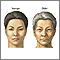 Changes in face with age Changes in face with age