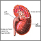 Hypertensive kidney Hypertensive kidney
