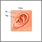 Newborn ear anatomy Newborn ear anatomy