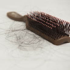 Hair Loss
