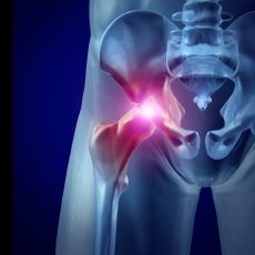 Hip Injuries and Disorders