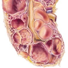 Kidney Cysts