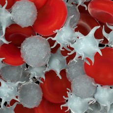 Platelet Disorders