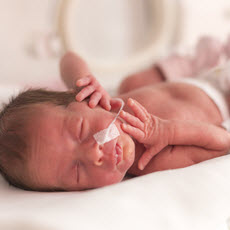 Premature Babies