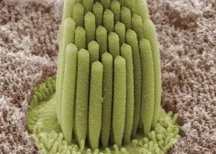 inner ear hair cell