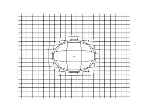 2d longitudinal wave