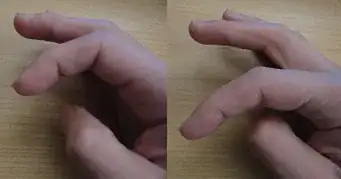 Hand pose