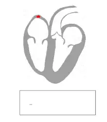 beating heart and strip chart animation