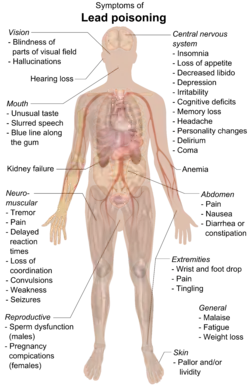 A chart of a human body with arrows pointing pieces of text to different parts of the body