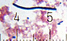 "Lactobacillus Bulgaricus” from a sample of yogurt. Numbered ticks are 11 μm apart.