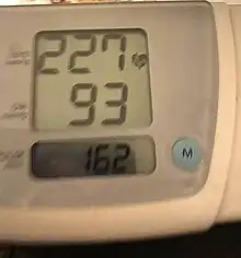 A photo of a home-owned automated arm blood pressure monitor showing an extremely elevated systolic blood pressure of 227 over a mildly elevated diastolic blood pressure of 93 with a tachycardic elevated heart rate of 162 beats per minute, representing an isolated systolic hypertensive crisis.