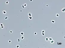 Abditibacterium utsteinense