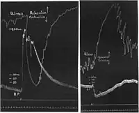 Adrenaline reversal after Henry Hallett Dale (1906). An ergot extract was injected between left-hand and right-hand tracings.