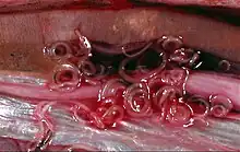 Unidentified Anisakidae (Ascaridina: Ascaridoidea)