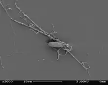 Aplanochytrium sp. under SEM