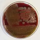 Bacillus cereus: "ground-glass" colonies displaying beta-hemolysis on blood agar: 188 