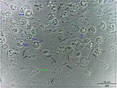 blastocystis spp. pathogenesis