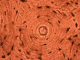 Whorled: Multiple concentric objects, or spiral-shaped