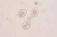 Coccidia oocysts in a fecal flotation from a cat. The cat was underweight and had diarrhea, showing signs of coccidiosis.