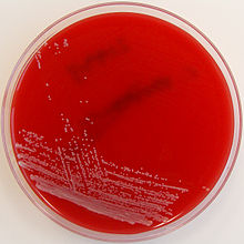 Colonies on HBA assuming a smooth and glossy colony morphology with approximately 1mm diameter.