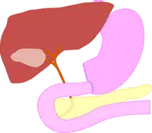 Diagram of the post-operation innards.