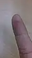 An incision: a small cut in a finger