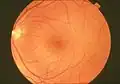 A normal human  fundus