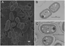 Scanning electron micrograph of Gloebacter kilaueensis JS1T cells grown in modified BG-11 liquid medium