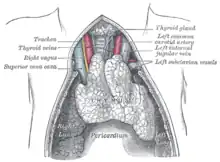 The thymus of a full-term fetus, exposed in situ