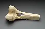 Femur bone with a hole caused by a bullet