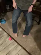 Male, late adolescent, with hypermobile type