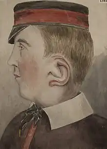 14-year-old boy with macrotia from hypertrophy