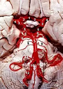 Human brainstem blood supply