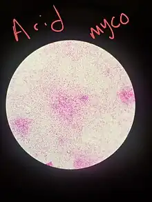 Photomicrograph of pink, innumerate small organisms unevenly distributed