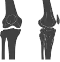 Anterior and lateral view of knee.