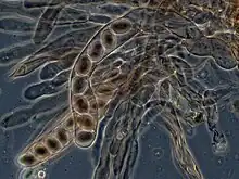 Microscopic view of numerous translucent or transparent elongated sac-like structures each containing eight spheres lined up in a row