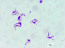Trypanosoma evansi in blood