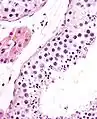 Seminiferous tubule (right) with sperm (black, tiny, ovoid). H&E stain.