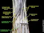 Extensor pollicis brevis muscle