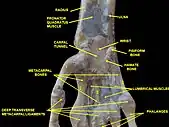 Wrist joint. Deep dissection. Anterior, palmar, view.